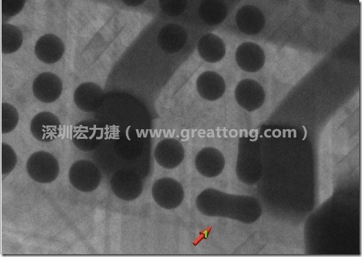 BGA因?yàn)楹笁|變小，造成錫膏過(guò)多而最終形成焊接短路的結(jié)果。